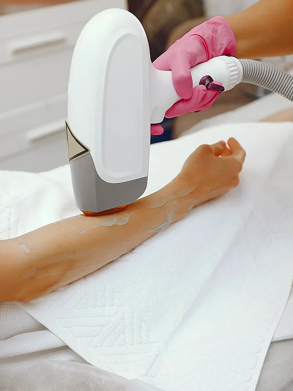 Αισθητικός εφαρμόζει αποτρίχωση με laser